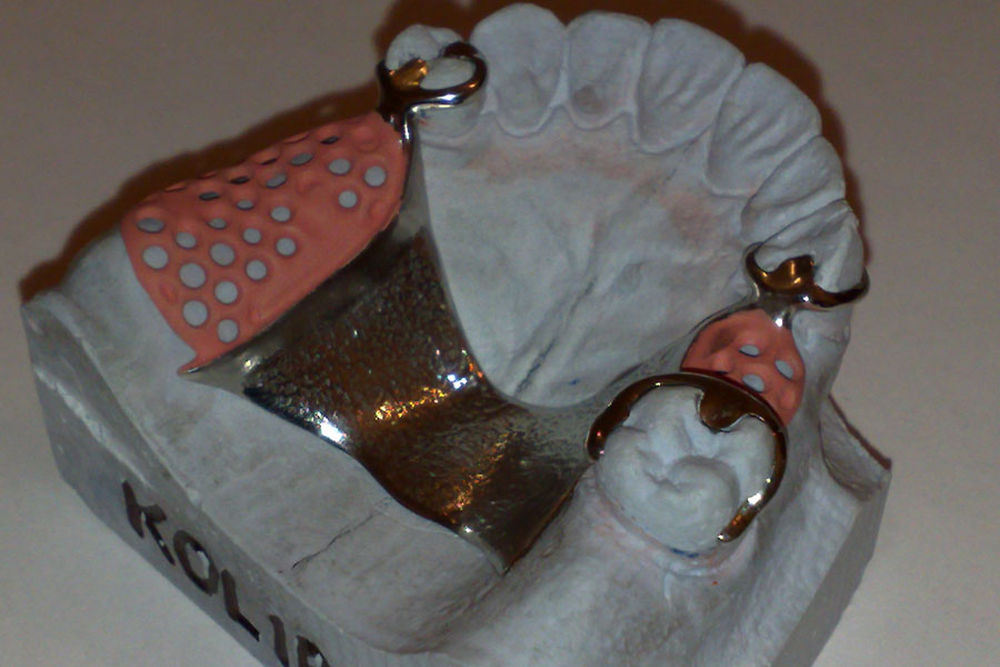 03112010327.jpg