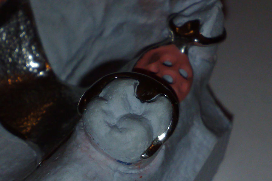 03112010328.jpg